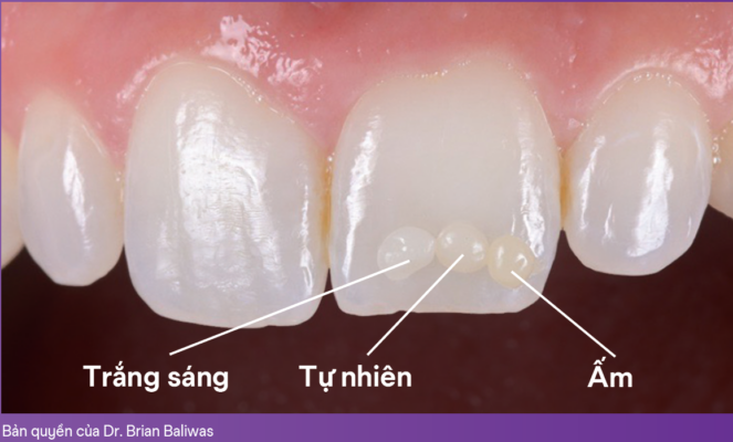 3M™ Filtek™ Easy Match